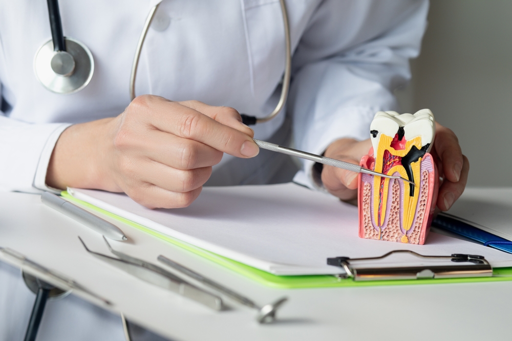 Root Canal Infections: Symptoms, Causes, Treatment, and Prevention