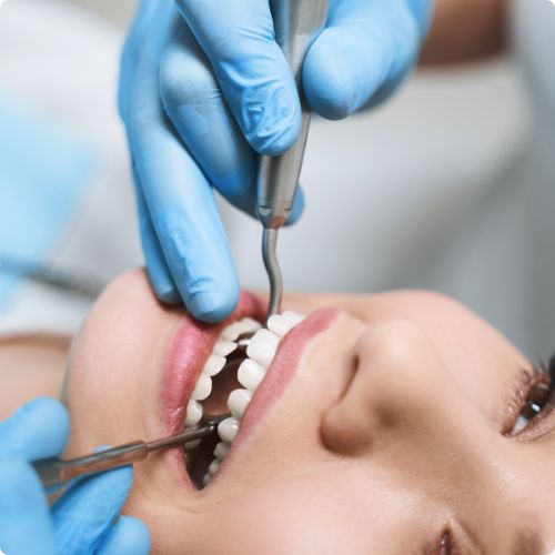Root Canal Treatment 1 root canal treatment georgetown
